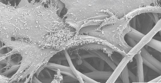 Materiały stosowane w medycynie – praca dla inżyniera – jak odbudować kość i zrobić inteligentny opatrunek.